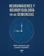 Neuroimágenes y neurofisiología en las demencias