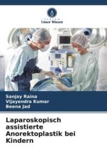 Laparoskopisch assistierte Anorektoplastik bei Kindern