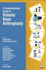 A Comprehensive Guide to Robotic Knee Arthroplasty