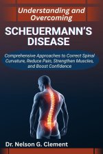 UNDERSTANDING AND OVERCOMING SCHEUERMANN'S DISEASE