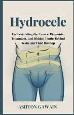 Hydrocele