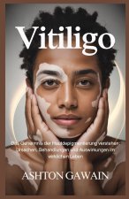Vitiligo