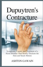 Dupuytren's Contracture