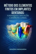 MÉTODO DOS ELEMENTOS FINITOS EM IMPLANTES DENTÁRIOS