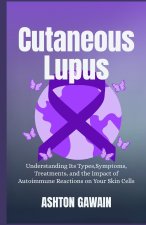 Cutaneous Lupus