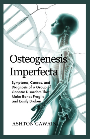 Osteogenesis Imperfecta