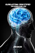 Glioblastoma demystifyied