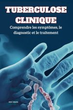 Tuberculose Clinique