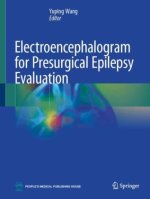 Electroencephalogram for Presurgical Epilepsy Evaluation