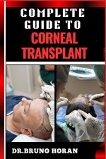 COMPLETE GUIDE TO CORNEAL TRANSPLANT