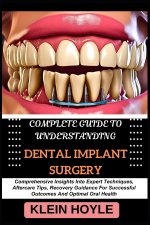 COMPLETE GUIDE TO UNDERSTANDING DENTAL IMPLANT SURGERY
