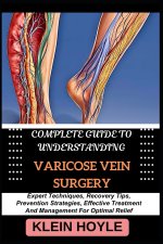 COMPLETE GUIDE TO UNDERSTANDING VARICOSE VEIN SURGERY