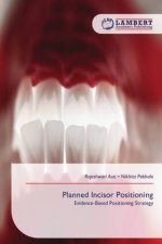 Planned Incisor Positioning
