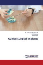 Guided Surgical Implants