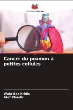 Cancer du poumon à petites cellules