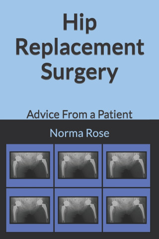 Hip Replacement Surgery