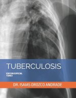 TUBERCULOSIS