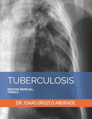 TUBERCULOSIS