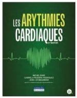 Les arytmies cardiaques