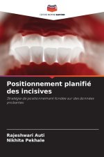 Positionnement planifié des incisives