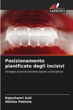 Posizionamento pianificato degli incisivi