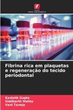Fibrina rica em plaquetas e regeneração do tecido periodontal