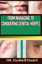 FROM MANAGING TO CONQUERING GENITAL HERPS