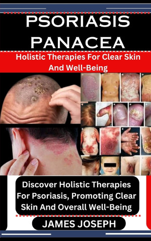 PSORIASIS PANACEA