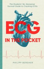 ECG in the Pocket