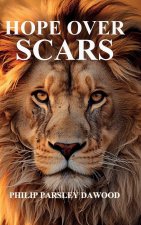HOPE OVER SCARS, How God Turns Pain Into Purpose And Scars Into Testimonies