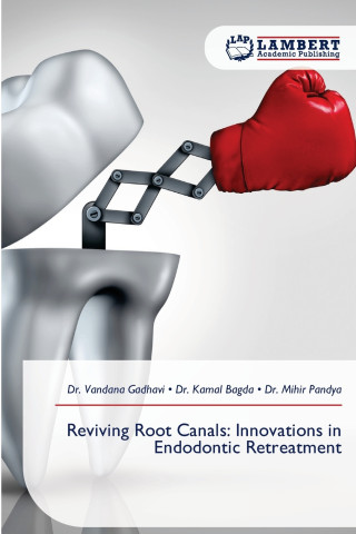 Reviving Root Canals
