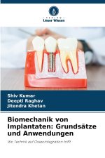 Biomechanik von Implantaten