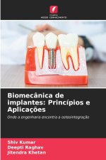 Biomecânica de implantes