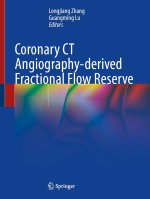Coronary CT Angiography-derived Fractional Flow Reserve
