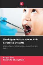 Moldagem Nasoalveolar Pré-Cirúrgica (PNAM)
