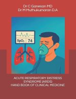 ACUTE RESPIRATORY DISTRESS SYNDROME - HAND BOOK OF CLINICAL MEDICINE