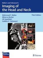 Mafee`s and Valvassori`s Imaging of the Head and Neck