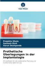 Prothetische Überlegungen in der Implantologie