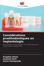 Considérations prosthodontiques en implantologie