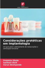 Considerações protéticas em Implantologia