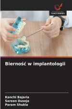 Bierność w implantologii