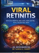 VIRAL RETINITIS