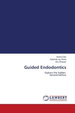 Guided Endodontics