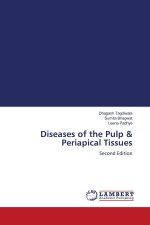 Diseases of the Pulp & Periapical Tissues