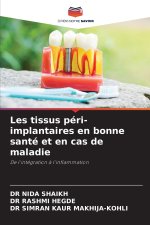 Les tissus péri-implantaires en bonne santé et en cas de maladie