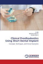 Clinical Prosthodontics Using Short Dental Implant