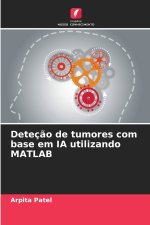 Deteção de tumores com base em IA utilizando MATLAB