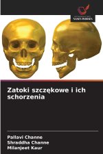Zatoki szczękowe i ich schorzenia