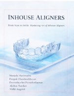 Inhouse aligner