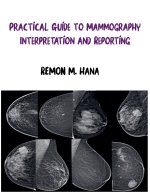 Practical Guide to Mammography Interpretation and Reporting
